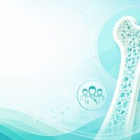 Destacada osteoporosis 355x266