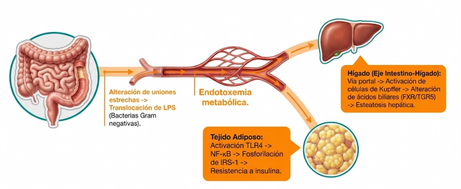 Infografía sobre endotoxemia metabólica causada por traslocación de LPS bacteriano.