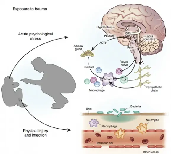 Exposición al trauma